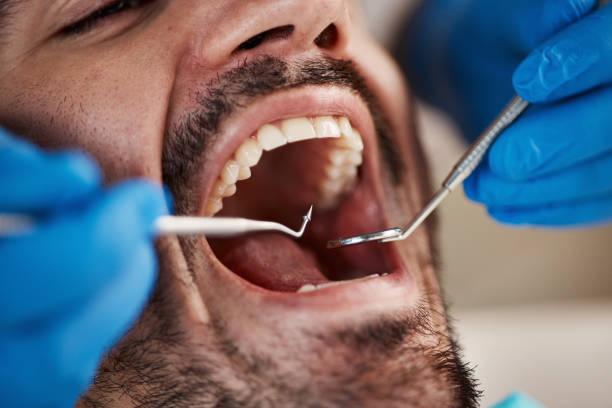 Best Dental Abscess Treatment in North Highlands, CA